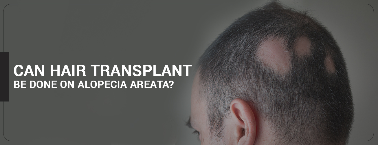 Benefits of PRP After Hair Transplant